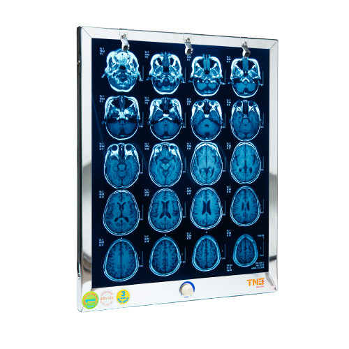 Đèn đọc film X-Quang, MRI